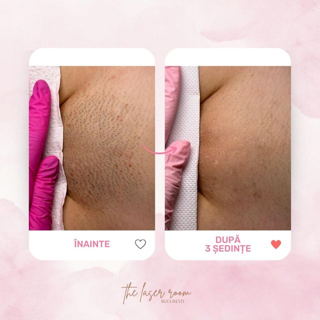 responsive image 33