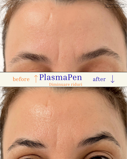 responsive image 30
