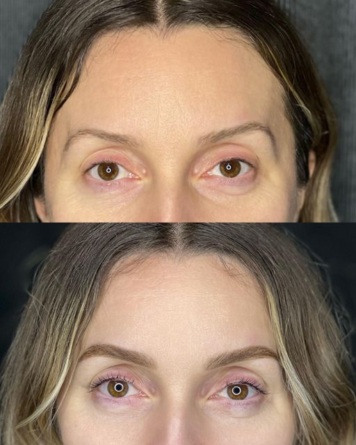 responsive image 18