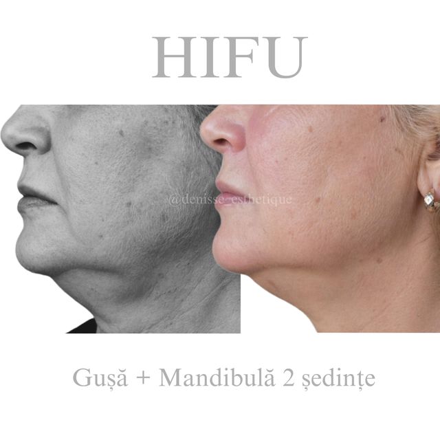 responsive image 31