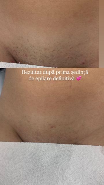 responsive image 17