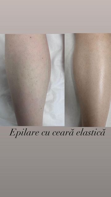 responsive image 21
