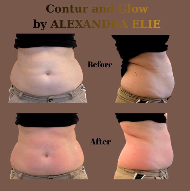 responsive image 46