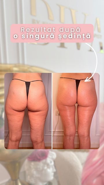 responsive image 28