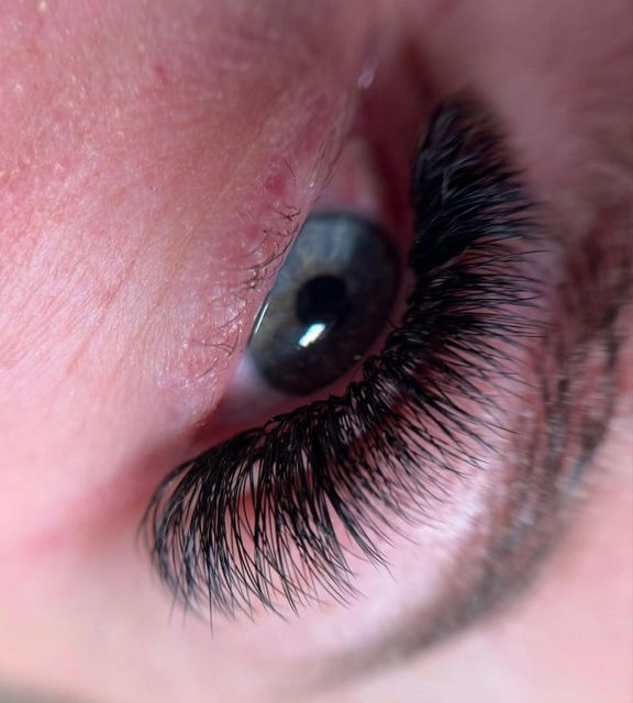 imagine galerie Aida extensii gene 6