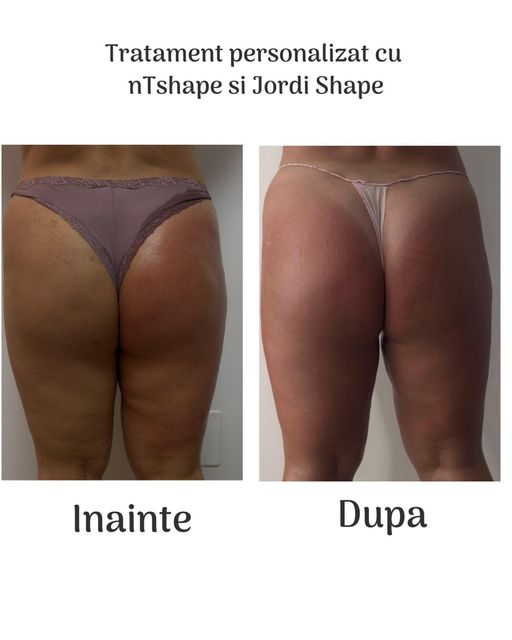 responsive image 101