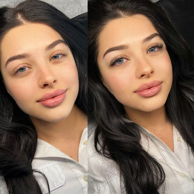 responsive image 0