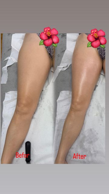 imagine galerie Cristina Private Beauty 2