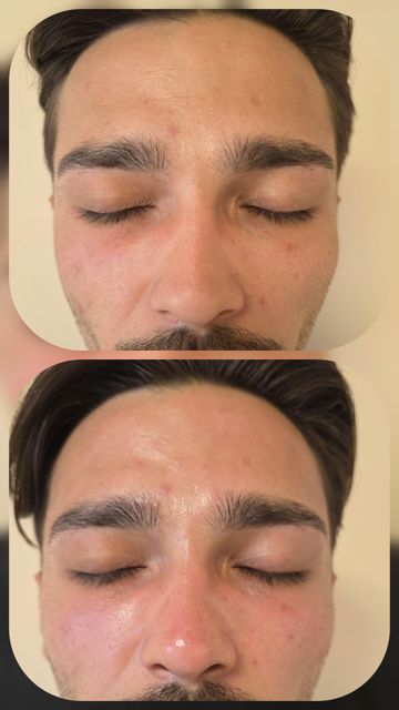 imagine galerie Skin Point Estet 6
