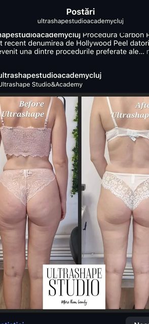 imagine galerie ULTRASHAPE STUDIO&ACADEMY 5
