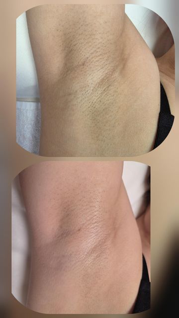 imagine galerie Skin Point Estet 5