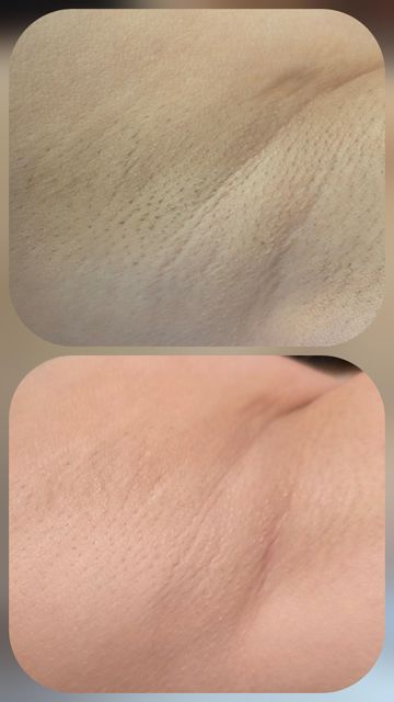 imagine galerie Skin Point Estet 6