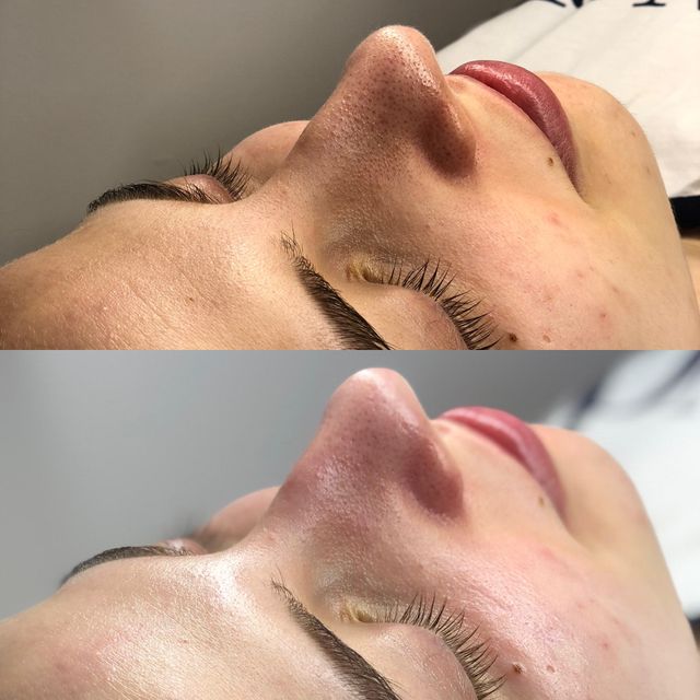 imagine galerie Alina Câmpan - Tratamente Faciale 4