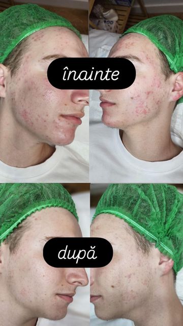 imagine galerie Bio Therapy co 4