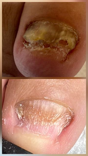 imagine galerie Ildy-Nailtech 1