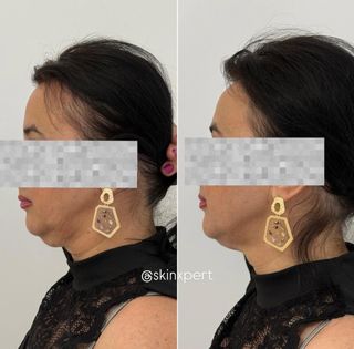 profile-image-34