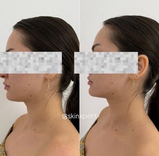 profile-image-36