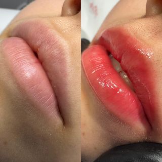 profile-image-45
