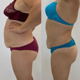 profile-image-41