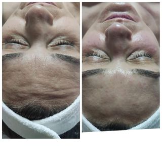 profile-image-15
