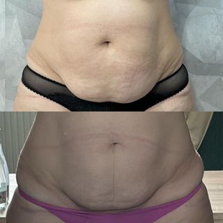 profile-image-42