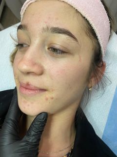 profile-image-59