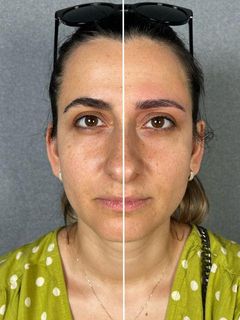 profile-image-146
