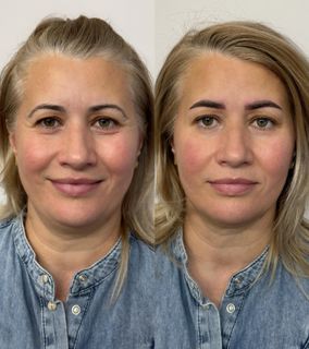 profile-image-35