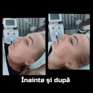 profile-image-85