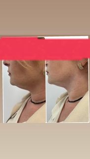 profile-image-111