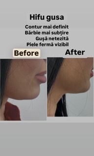 profile-image-113