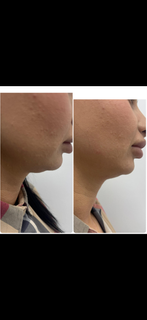 profile-image-117