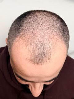 profile-image-38