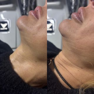 profile-image-18
