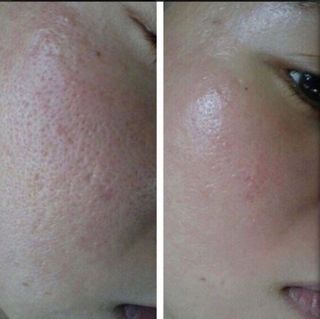 profile-image-93