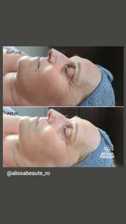 profile-image-56