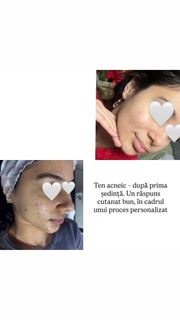 profile-image-44