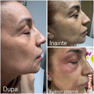 profile-image-52