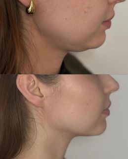 profile-image-77