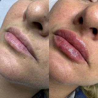 profile-image-43