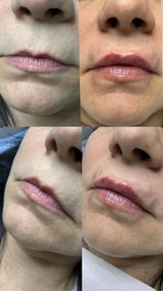 profile-image-93