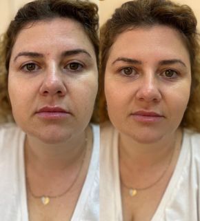 profile-image-66