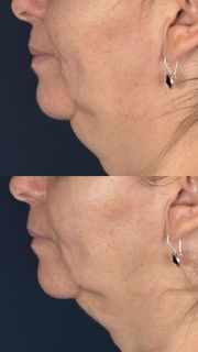 profile-image-9