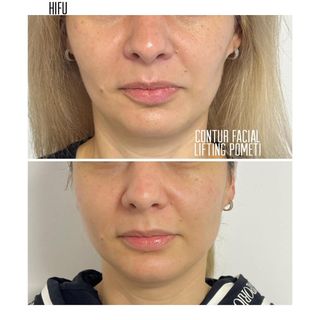 profile-image-78