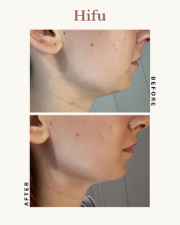 profile-image-11