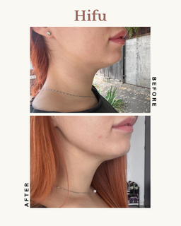 profile-image-20