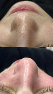 profile-image-64