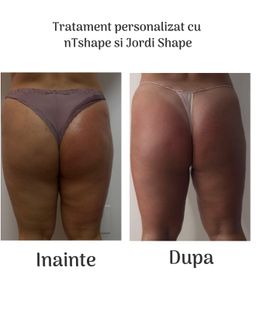 profile-image-101