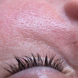 profile-image-77
